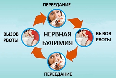 Лечение булимии в Кировском